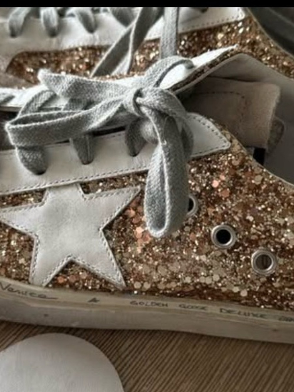 Golden Goose High Star Shoes - Picture 2 of 6